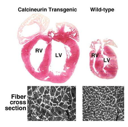 Calcineurin transgenic versus wild-type.